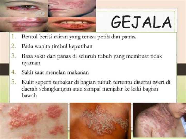 Apakah penyakit HBsAg Menular?