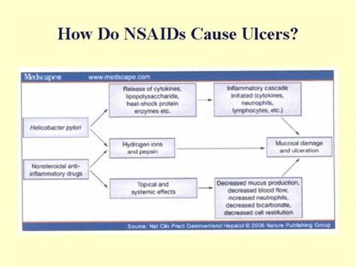 Do iv NSAIDs cause ulcers?
