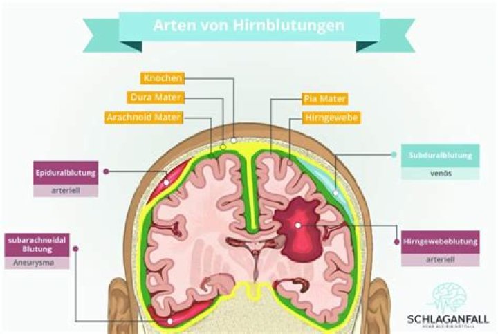 Wie ist die Blutung bei einer Fehlgeburt?